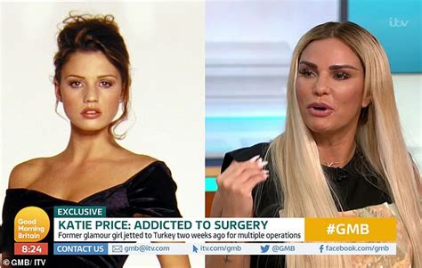 Katie Price Left Bruised As She Undergoes Plastic Surgery Again While