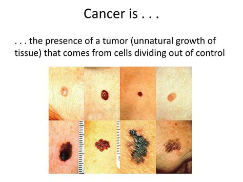Ppt Cancer Basics Powerpoint Presentation Free Download Id2000370
