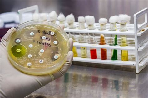 Quais Os Principais M Todos De Testes De Sensibilidade A Antimicrobianos