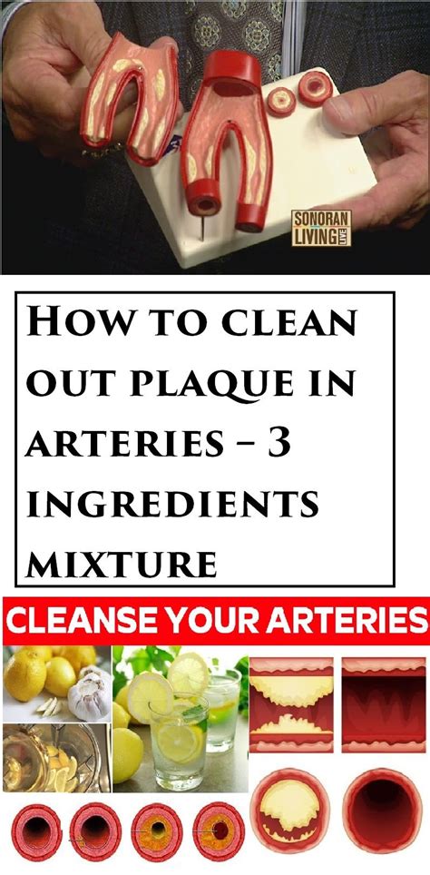 how to clean out plaque in arteries 3 ingredients mixture arteries