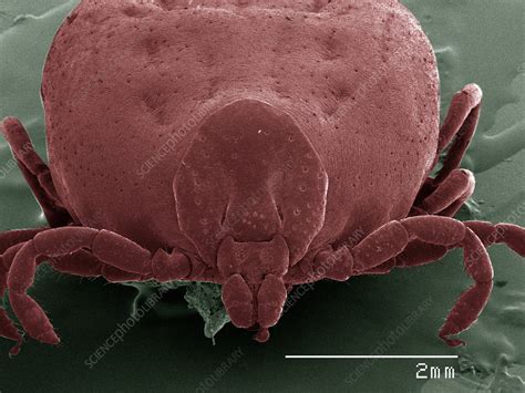 Coloured Sem Of Tick Front View Stock Image F0102973 Science
