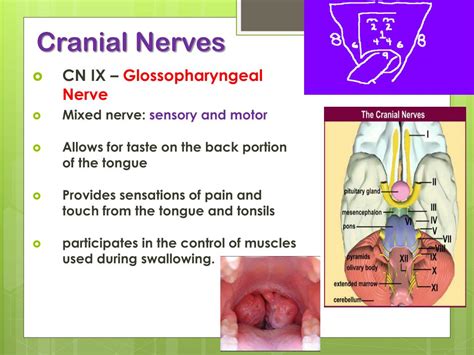 Cranial Nerve 2