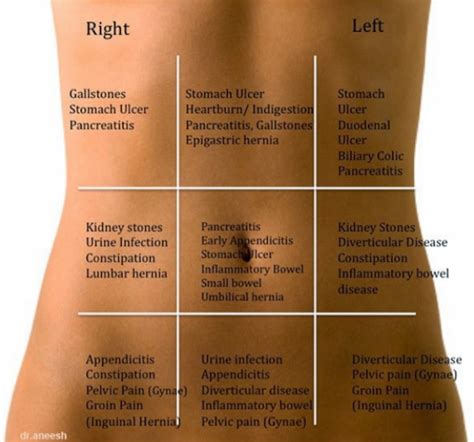 4 Abdominal Quadrants By Pathology Health And Beauty Tips Health And
