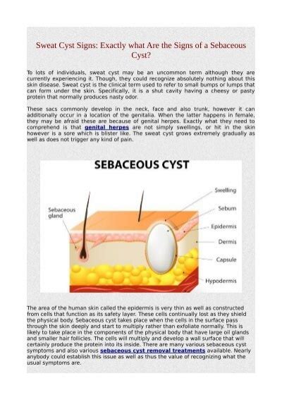 Sweat Cyst Signs Exactly What Are The Signs Of A Sebaceous Cystpdf