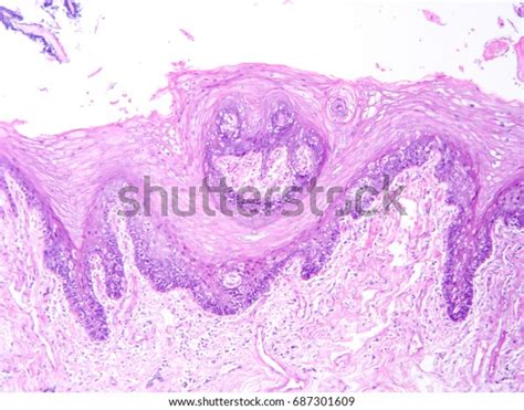 Photo De Stock Histology Human Submaxillary Gland Tissue Show 687301609