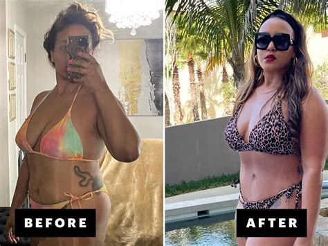 Transform Your Obese Tummy: Before and After Tummy Tuck Results - I'm