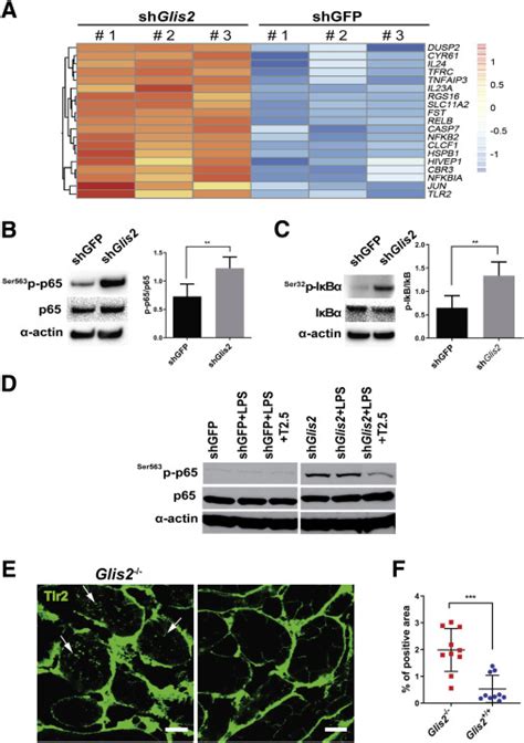 Innate Immune Signaling Contributes To Tubular Cell Senescence In The