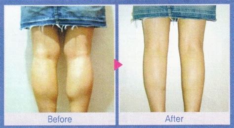 The Japanese Method Of Getting Skinny Legs Caloriebee