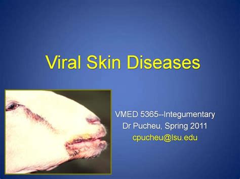 Ppt Viral Skin Diseases Powerpoint Presentation Free Download Id