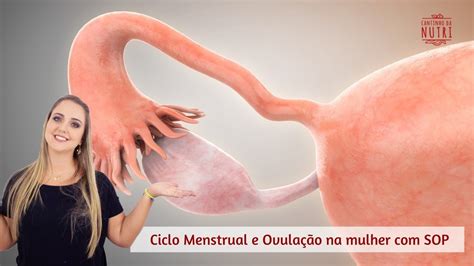 Ciclo menstrual e ovulação na mulher com SOP YouTube