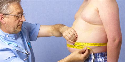 Nhs To Appeal Government To Motivate Obese People To Lose Weight With