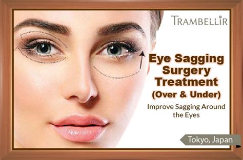 Eye Sagging Surgery Treatment Improve Sagging Around The Eyes