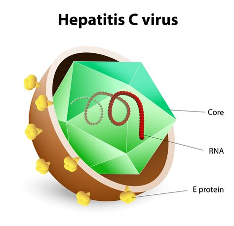 Hcv, oda sıcaklığında tutulmuş yüzeylerde 3 haftaya kadar yaşayabilmesi akut ve kronik hepatit c hastalığı olguları için çeşitli tedaviler mevcuttur. Hepatitis C Symptoms, Treatment, Causes, What is Hepatitis C