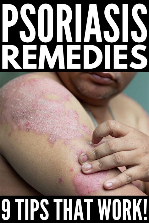 How To Get Rid Of Psoriasis 9 Tips And Remedies To Try Psoriasis