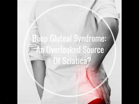 Deep Gluteal Syndrome YouTube