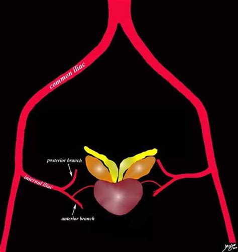 Prostate Applied Anatomy