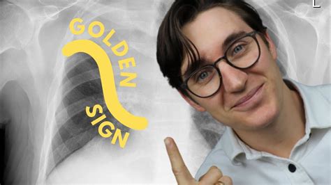 The Golden S Sign Explained Youtube