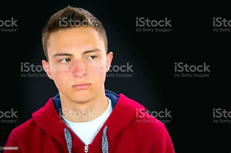 Portrait Of Teenage Boy With Acne Stock Photo Download Image Now