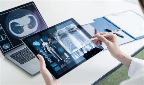 Medical Imaging Informatics Market Accelerated By Cloud And Ai To