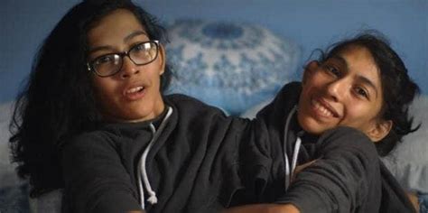 Who Are The Conjoined Twins From Tlcs Conjoined Twins Inseparable Meet Carmen And Lupita