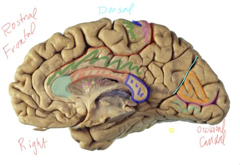 Medial Slice Of Brain Diagram Quizlet