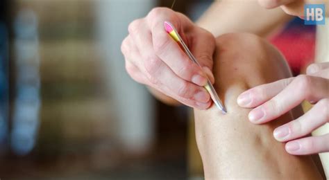 Ingrown hairs occur more frequently in areas that experience a lot of friction. What Causes Ingrown Leg Hairs and How to Prevent Them