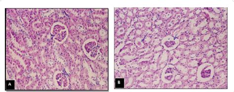 Renal glycosuria is not infrequent in the elderly where renal threshold for glucose is lowered below normal of 180 mg/dl or in inherited tubular defects. Control animals. A: showing the normal histology of renal ...