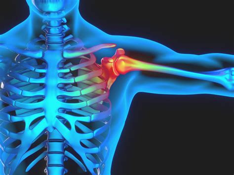 Dealing With Common Shoulder Injuries Perea Clinic