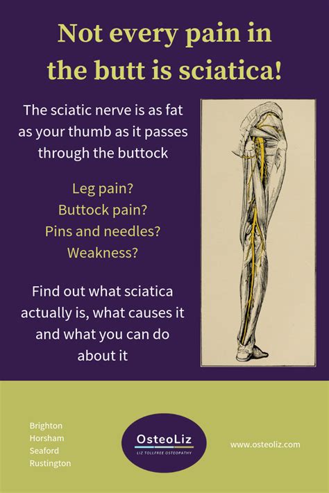 Pin On Sciatica And Trapped Nerves