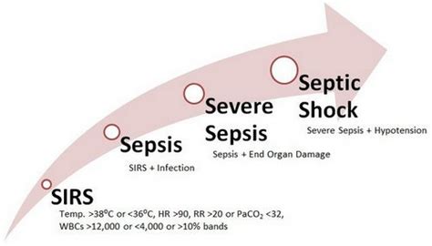 What Is Sepsis And Septicemia Definition Icd 10 Symptoms Criteria