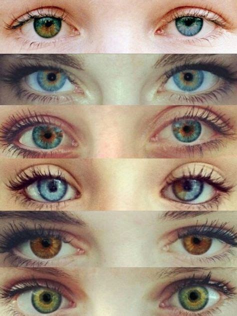 I Have Central Heterochromia Eyes Second Down Would Be Cool To Have