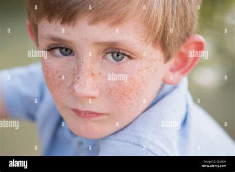 Young Boy With Freckle Stock Photo Image Of Freckle 246