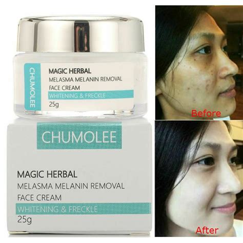 Chumolee Strong Whitening Cream Freckle Cream Remove Melasma Acne Dark