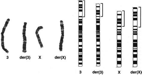 Sex Chromosomes Sex Chromosome Disorders And Disorders Of Sex Development Basicmedical Key