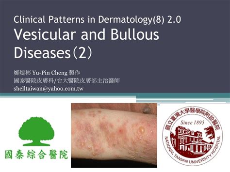 台大皮膚部國泰皮膚科clinical Patterns In Dermatology9 20 Vesicular And Bullous Diseases（2） 鄭煜彬的皮膚科學研究室