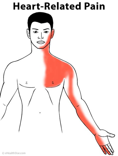 Arm Pain Left Right Both Sharp Dull Muscle Nerve In Women