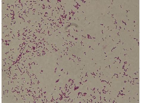 Gram Stain Picture Of Corynebacterium Diphtheriae Showing Gram Positive