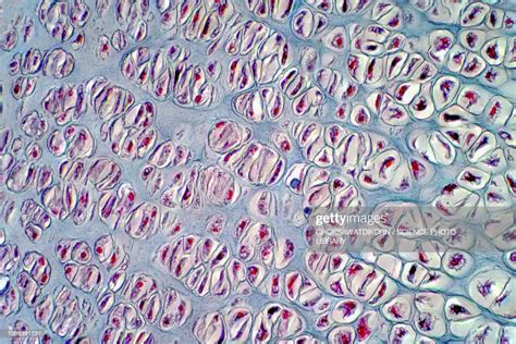 Human Cartilage Bone Light Micrograph High Res Stock Photo Getty Images