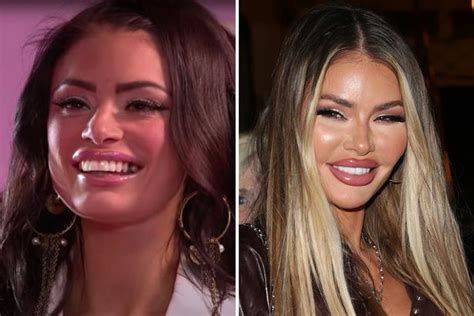 Chloe Sims Shows Off Natural Look After Having Fillers Dissolved In Make Up Free Video Ok