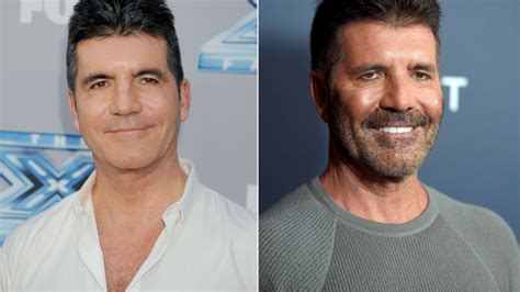 Simon Cowell Admits He Went ‘too Far’ With Botox After Unrecognisable Transformation 7news