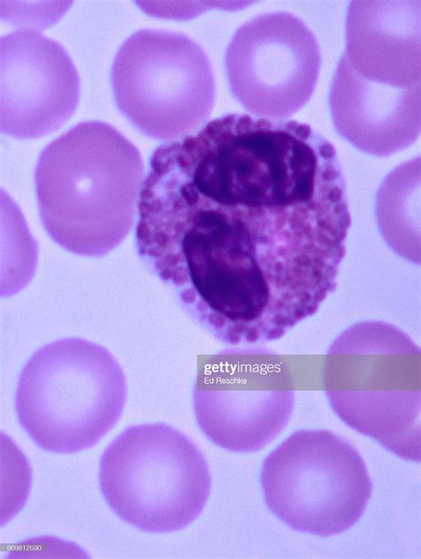 White Blood Cell Eosinophil Human Blood Smear 400x High Res Stock Photo