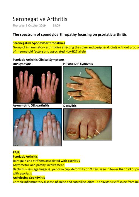 Seronegative Arthritis The Spectrum Of Spondyloarthropathy Focusing