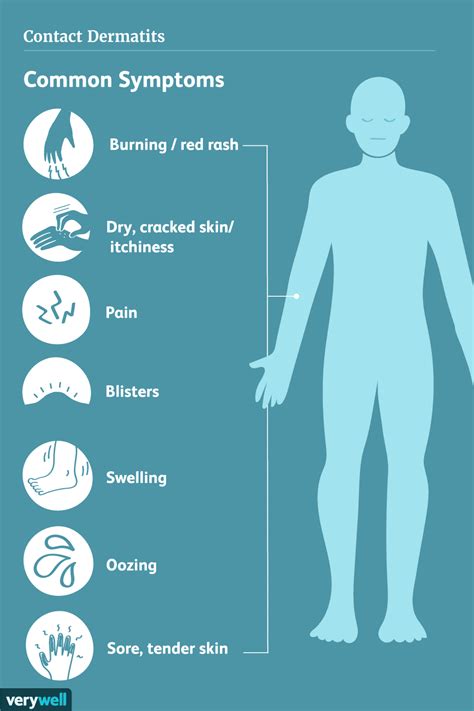 Contact Dermatitis Signs Symptoms And Complications