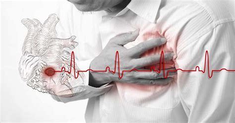 Angina Chest Pain And Tightness Symptoms Types And Treatment