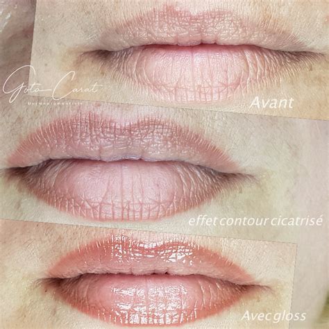 Maquillage Permanent Des L Vres Effet Contour Cicatris Apr S S Ances