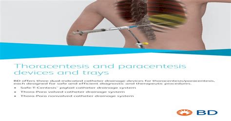 Thoracentesis And Paracentesis Devices And Traysthoracentesis And