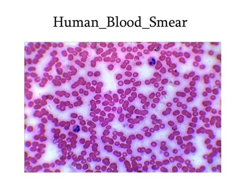 1 Human Blood Smear