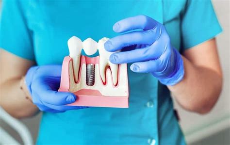 7 Signs Of Dental Implant Operation Failure Cosmeticium