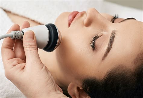 your guide to radio frequency skin treatments — results side effects and cost allure