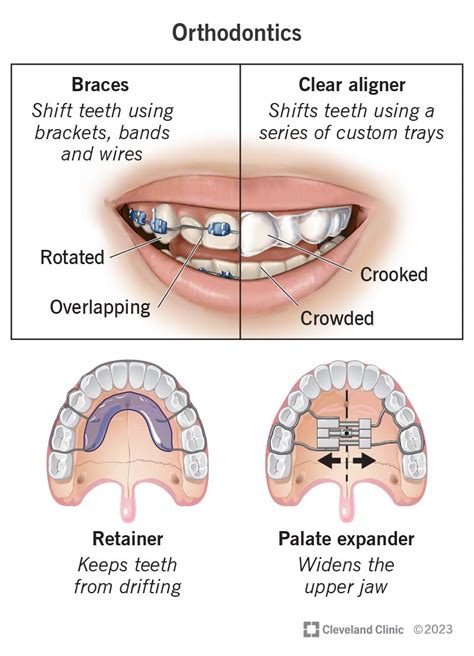 What Is Orthodontics